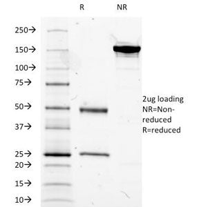 SDS-PAGE Analysis of Purified, BSA-Free MUC5AC Antibody (clone 2-11M1). Confirmation of Integrity an