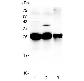 Western blot testing of 1) rat liver, 2) mouse liver and 3) mouse HEPA1-6 lysate with MBL2 antibody