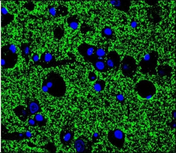 Synaptophysin Antibody