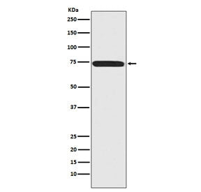 Menin Antibody / MEN1