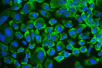 RENT1 / hUPF1 Antibody
