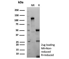 SDS-PAGE analysis of purified recombinant TSHR beta antibody (clone TSHRB/9215R) as confirmation of