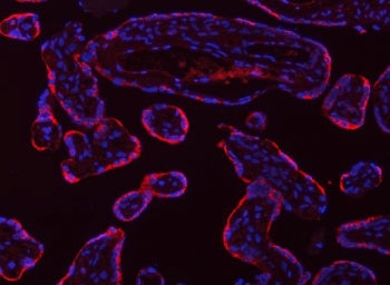 Immunofluorescent staining of FFPE human placental tissue with Tropomyosin 2 antibody (red) and DAPI