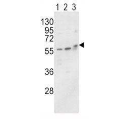 Western blot analysis of ALP / Alkaline Phosphatase antibody and MCF-7 (lane 1), HL-60 cell line (2)