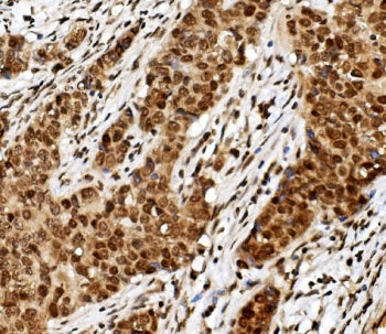 TIF1 gamma Antibody / TRIM33