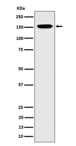 Western blot analysis of NUP155 expression in human 293 cell lysate using NUP155 antibody. Predicted