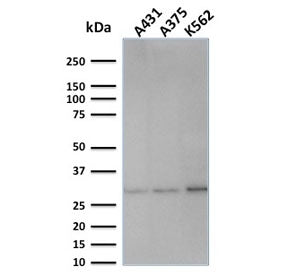 Western blot testing of human samples with Replication Protein A2 antibody (clone SPM316). Expected