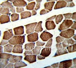 IHC testing of FFPE human skeletal muscle tissue with ATP5O antibody. HIER: steam section in pH6 cit