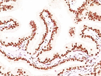 Androgen Receptor Antibody Cocktail