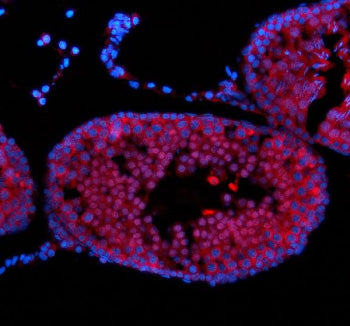 Immunofluorescent staining of NUP50 using anti-NUP50 antibody (red). NUP50 was detected in a paraffi