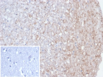Calretinin / Calbindin 2 Antibody