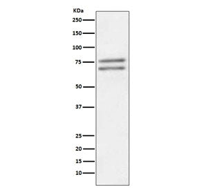 Western blot testing of human Jurkat cell lysate with ADAM10 antibody. Predicted molecular weight: ~