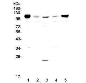 Western blot testing of rat 1) spleen, 2) thymus, 3) testis, 4) kidney and 5) lung lysate with Vcam-