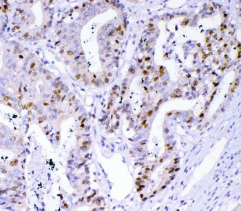 Survivin Antibody