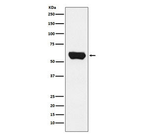 Western blot testing of human Jurkat cell lysate with LCK antibody. Predicted molecular weight ~58 k