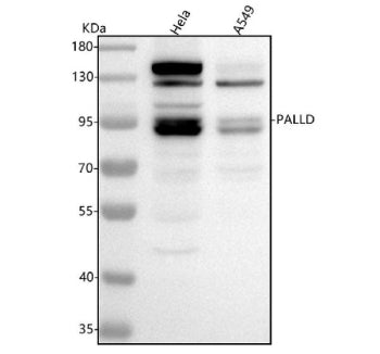 Western blot analysis of Palladin using anti-Palladin antibody. Lane 1: human Hela whole cell lysate