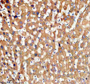 Immunohistochemical staining of TDO2 using anti-TDO2 antibody. TDO2 was detected in a paraffin-embed