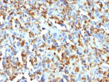 Factor XIIIa Antibody / F13A1