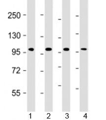 TPX2 Antibody / Targeting protein for Xklp2