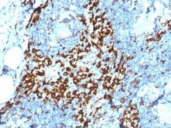 IHC testing of FFPE human lymph node with CD163 antibody (clone M130/2164). HIER: boil tissue sectio