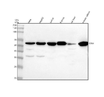 Western blot analysis of MST1/STK4 using anti-MST1 antibody. Lane 1: human Hela whole cell lysates,