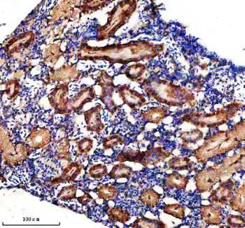 IHC staining of FFPE zebrafish kidney tissue with Zebrafish Dlst antibody, HRP secondary and DAB sub