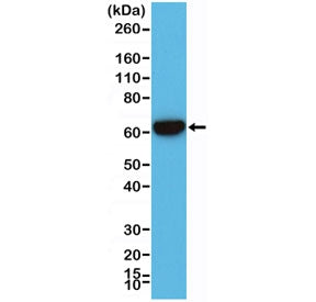Western blot testing of human A431 cell lysate with recombinant Cytokeratin 5/6 antibody. Predicted