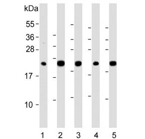 Western blot testing of human 1) liver, 2) HepG2, 3) 293T, 4) kidney and 5) ThP-1 lysate with GPX1 a