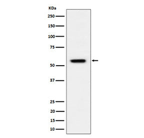 Western blot analysis of Phospho-Vimentin (S39) expression in HeLa treated with Calyculin A cell lys