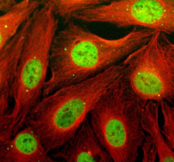 Immunofluorescent staining of TCF20 using anti-TCF20 antibody (green) and anti-Beta Tubulin antibody