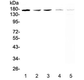Western blot testing of 1) human A549, 2( (h) SK-OV-3, 3) (h) PANC-1, 4) rat brain and 5) mouse brai