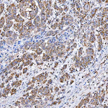 SUCLG2 Antibody / Succinate-CoA ligase GDP-forming subunit beta, 100ug