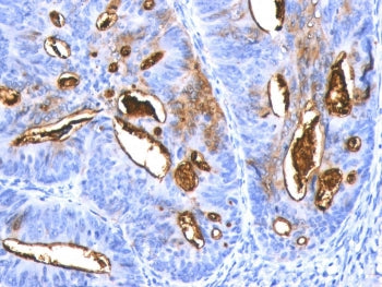 CA19-9 Antibody