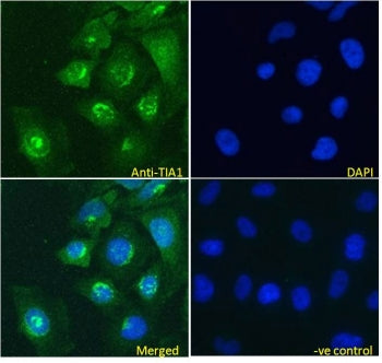 Immunofluorescent staining of fixed and permeabilized human HeLa cells with TIA1 antibody (green) at