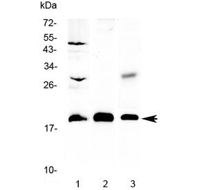 TMEM240 Antibody