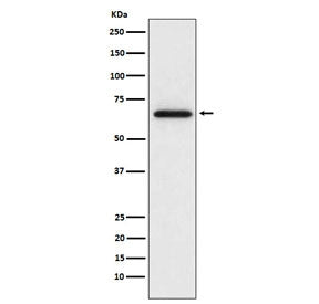 Western blot testing of rat L6 cell lysate with MMP2 antibody. Expected molecular weight: ~72 kDa (p