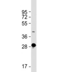 Western blot testing of human skeletal muscle lysate with DNASE1L2 antibody at 1:2000. Predicted mol