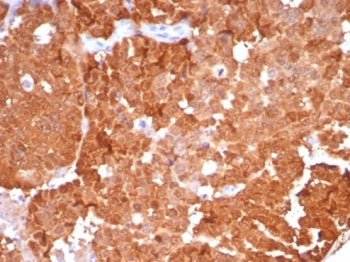 p16INK4a Antibody / CDKN2A