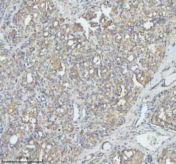 Immunohistochemical staining of TOM1 using anti-TOM1 antibody. TOM1 was detected in a paraffin-embed
