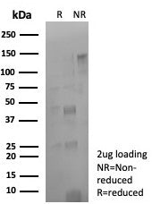 PD-L1 Antibody / B7-H1 / CD274