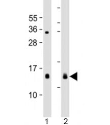 Western blot testing of 1) mouse heart and 2) rat spleen lysate with YPEL3 antibody at 1:2000. Predi