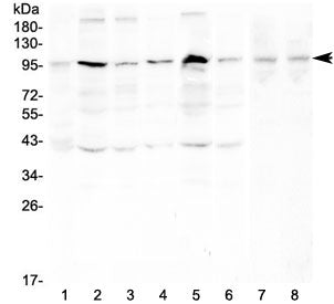 RPS6KA2 Antibody / RSK3