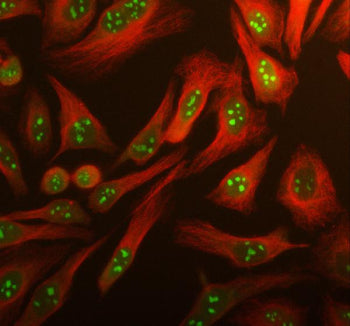 Immunofluorescent staining of using anti-ARL3 antibody (green) and anti-Beta Tubulin antibody (red).