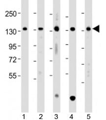 TACC3 Antibody