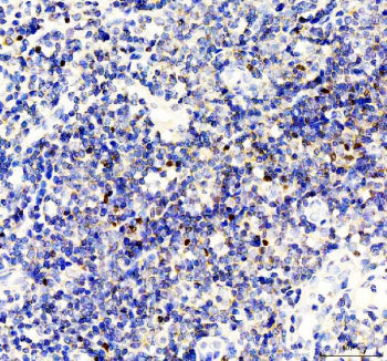 IHC staining of FFPE human tonsil tissue with FOXP3 antibody, HRP-labeled secondary and DAB substrat