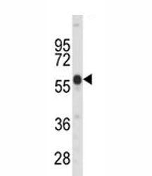 Western blot analysis of PINK1 antibody and mouse kidney tissue lysate. Predicted molecular weight: