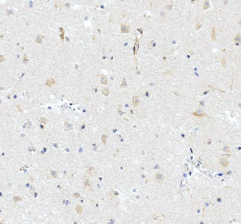 IHC staining of FFPE human brain tissue with iNOS antibody, HRP-secondary and DAB substrate. HIER: b