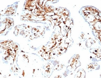 S100A4 Antibody / FSP1