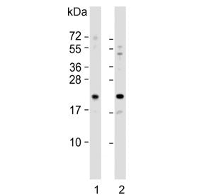 Western blot testing of human 1) HeLa and 2) HepG2 cell lysate with Glyoxalase I antibody. Predicted
