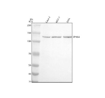 Western blot analysis of EPHA4 using anti-EPHA4 antibody. Electrophoresis was performed on a 8% SDS-